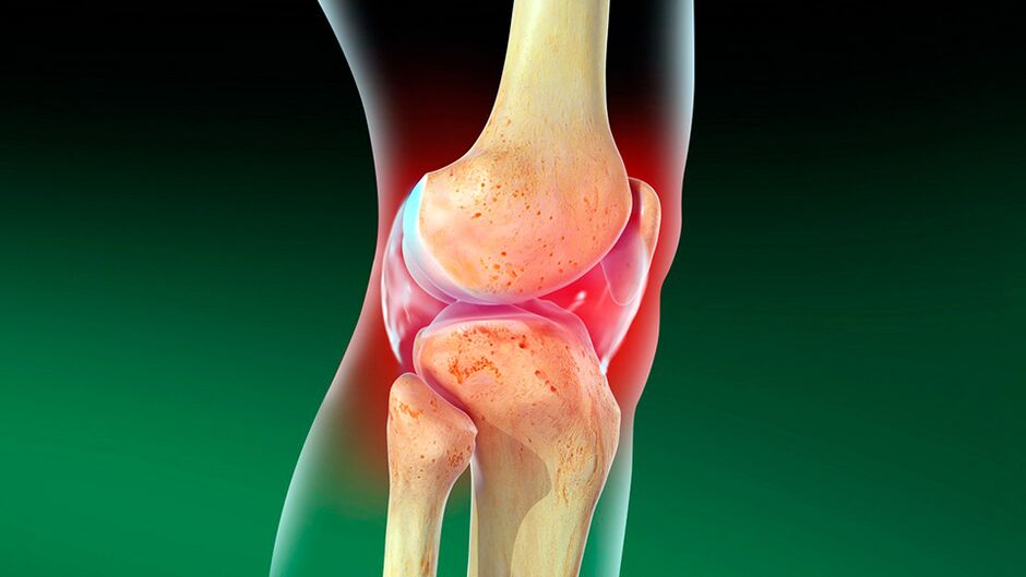 knee joint disease